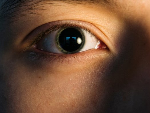 LSD Effects on Eyes and Pupils
